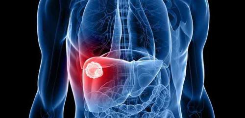 Концентрат сафлора вред. Сафлор: лечебные свойства и противопоказания, польза и вред