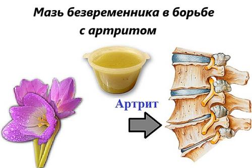 Лечебные свойства безвременника осеннего — когда яд становится лекарством для больных раком