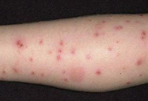 Черная мошка. Двукрылое насекомое