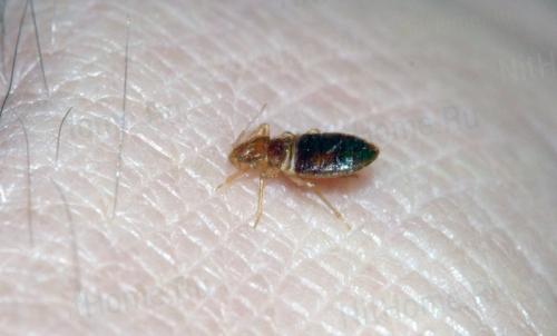 Откуда могут появиться клопы в квартире. Как и почему заводятся клопы 01 Откуда могут появиться клопы в квартире. Как и почему заводятся клопы 01