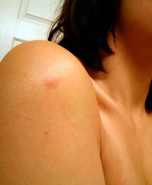 Клопы, как появляются в квартире. Как появляются клопы в квартире – пути их проникновения 05 Клопы, как появляются в квартире. Как появляются клопы в квартире – пути их проникновения 05