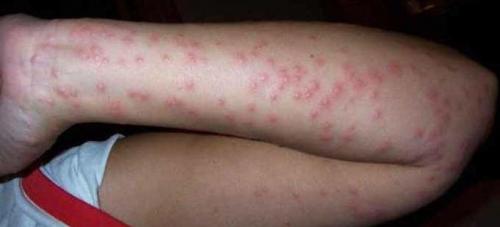 В какое время года появляются клопы. В какое время клопы выходят на охоту?