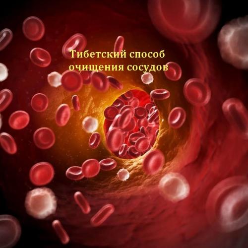 Настойка из чеснока и лимона для чистки сосудов тибетский рецепт. Чистка сосудов чесноком и спиртом — тибетский рецепт настойки, схема приема 11 Настойка из чеснока и лимона для чистки сосудов тибетский рецепт. Чистка сосудов чесноком и спиртом — тибетский рецепт настойки, схема приема 11