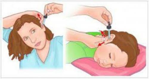 Чесночное масло для ушей. 