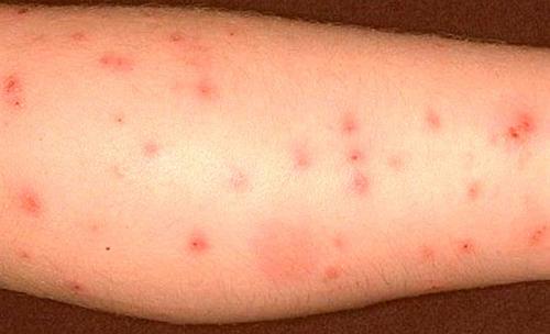 Откуда берутся клопы в частном доме. Как обнаружить в квартире клопа: признаки насекомого и его описание