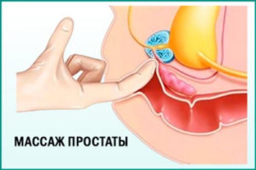 Семена укропа при простатите. Народные рецепты с укропом