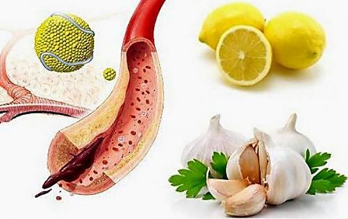 Чистим сосуды чесноком. Чеснок для чистки сосудов: 8 рецептов