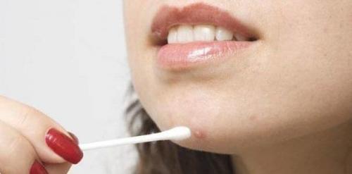 Борная кислота турунды в ухо. Борная кислота в растворе и порошке: инструкция по использованию для лечения ушей и при прыщах