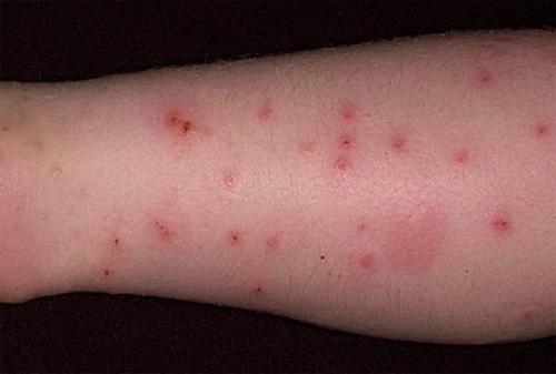 Земляные блохи в доме: откуда появляются, как избавиться?