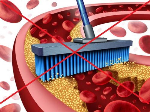 Чеснок и лимон польза и вред. Смесь чеснока, лимона и меда чистит сосуды: правда или миф?