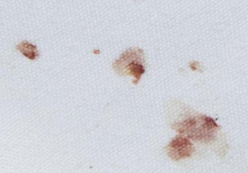 От чего появляются клопы постельные. Перемещение в вещах 09