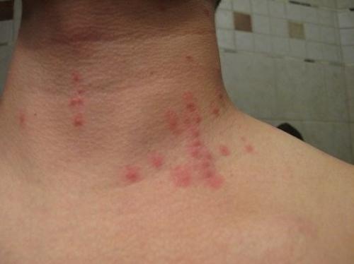 Откуда берутся клопы в квартире. Откуда ждать беды? Причины появления клопов 13