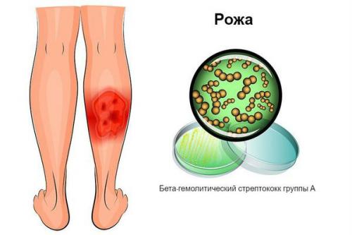 Лечение парши на груше. Признаки парши на груше 02