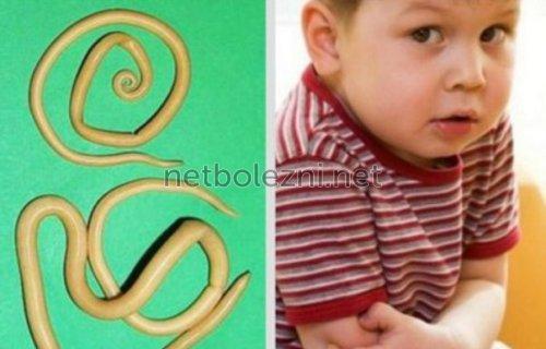 Можно ли по калу определить заболевание кишечника. 04 Можно ли по калу определить заболевание кишечника. 04