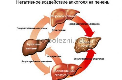 Можно ли по калу определить заболевание кишечника. 02 Можно ли по калу определить заболевание кишечника. 02