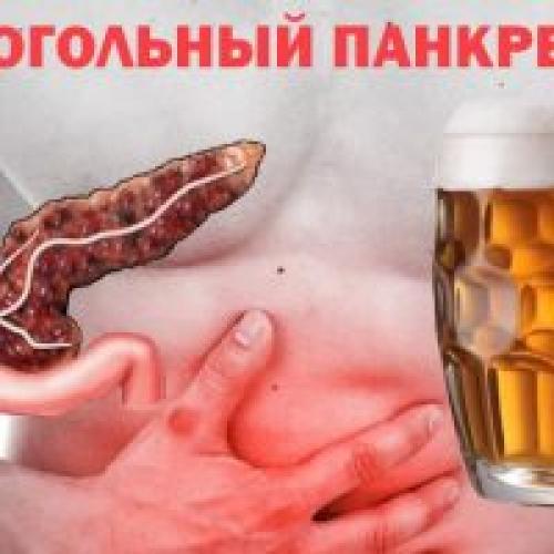 Хронический панкреатит сколько живут. Хронический панкреатит. Причины развития