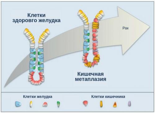 Как восстановить защитные свойства желудка.. Патогенез острого гастрита 05 Как восстановить защитные свойства желудка.. Патогенез острого гастрита 05