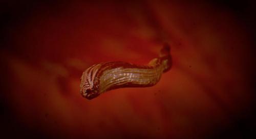 Сэм боллард. Подросток съел на спор слизняка и умер