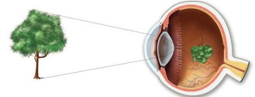 7 мифов о восстановлении зрения. Ми.  Пока я нормально вижу, к окулисту идти не надо 05