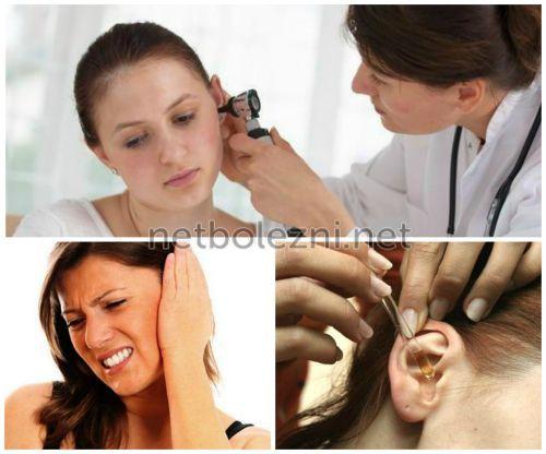 Ушные капли при боли в ухе. Лучшие средства от отита 01
