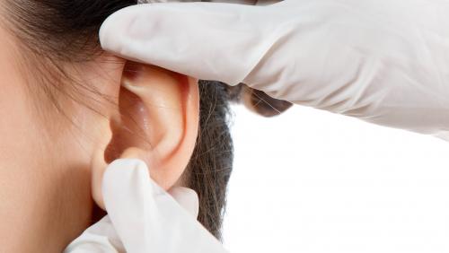 Эффективное применение борной кислоты в растворе для лечения различных проблемных участков кожи 01