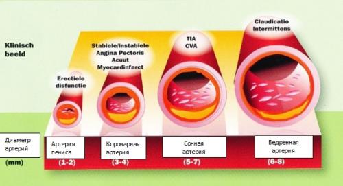 Изучаем причины эректильной дисфункции у мужчин старше 50 лет 01