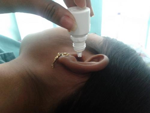 Борная кислота для уха детям. Пошаговая инструкция, как правильно закапать