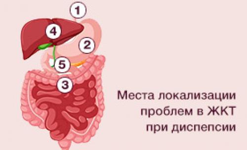 Все, что нужно знать о диспепсии желудка: симптомы и методы лечения 03
