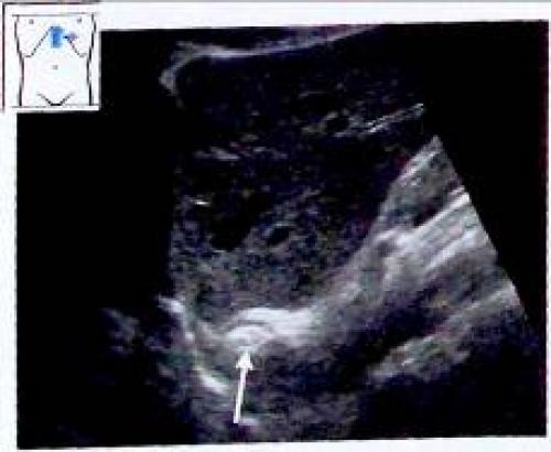 Как правильно определить причины несварения желудка: всё, что нужно знать 05