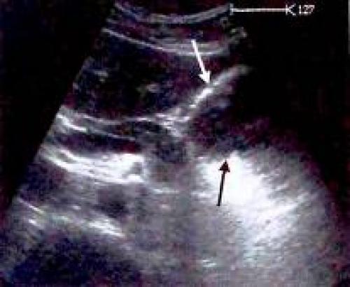 Как правильно определить причины несварения желудка: всё, что нужно знать 08