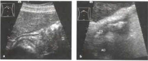 Как правильно определить причины несварения желудка: всё, что нужно знать 04
