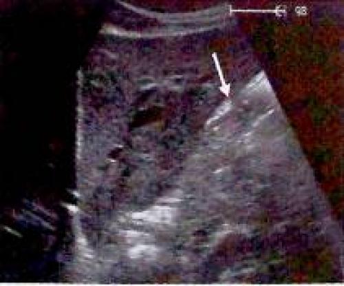 Как правильно определить причины несварения желудка: всё, что нужно знать 06