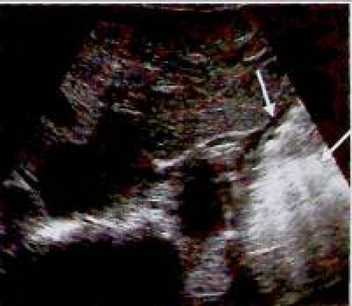 Как правильно определить причины несварения желудка: всё, что нужно знать 03