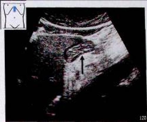 Как правильно определить причины несварения желудка: всё, что нужно знать 01