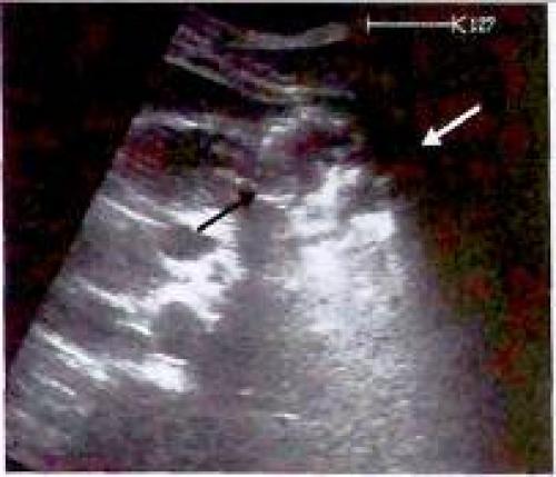 Как правильно определить причины несварения желудка: всё, что нужно знать 09